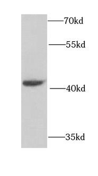 NCK2 Rabbit Polyclonal Antibody