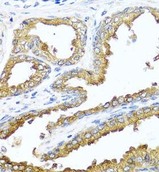 NCK2 Rabbit Polyclonal Antibody