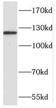 NCKAP1 Rabbit Polyclonal Antibody