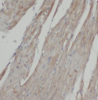 NCKAP1 Rabbit Polyclonal Antibody