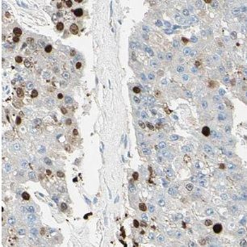 NCLN Rabbit Polyclonal Antibody
