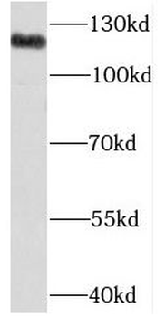 NCOR1 Rabbit Polyclonal Antibody