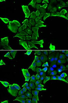 NCS1 Rabbit Polyclonal Antibody