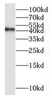 MT ND2 Rabbit Polyclonal Antibody