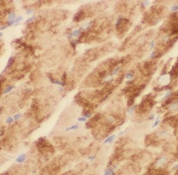MT ND2 Rabbit Polyclonal Antibody