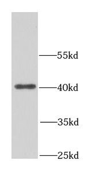 NDE1 Rabbit Polyclonal Antibody