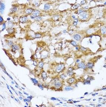 NDE1 Rabbit Polyclonal Antibody