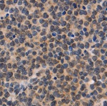 NDOR1 Rabbit Polyclonal Antibody