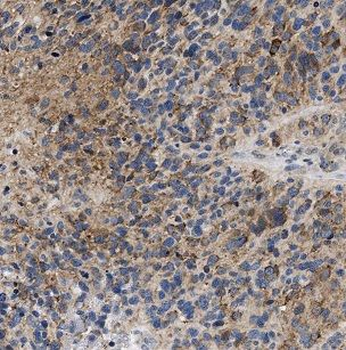 NDRG4 Antibody