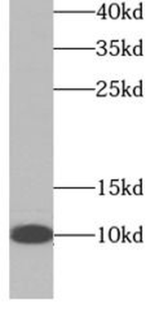 NDUFA4L2 Rabbit Polyclonal Antibody