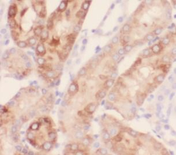 NDUFA4L2 Rabbit Polyclonal Antibody