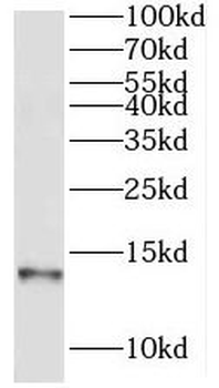 NDUFA5 Rabbit Polyclonal Antibody