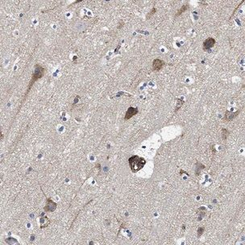 NDUFA5 Rabbit Polyclonal Antibody