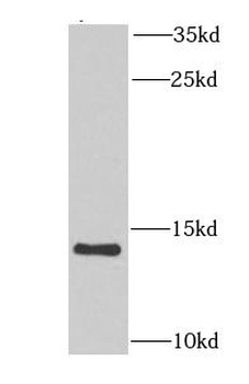 NDUFA6 Rabbit Polyclonal Antibody