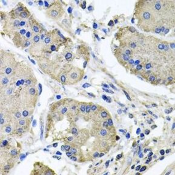 NDUFA6 Rabbit Polyclonal Antibody