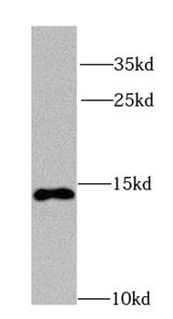 NDUFA7 Rabbit Polyclonal Antibody