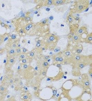 NDUFA7 Rabbit Polyclonal Antibody