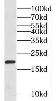 NDUFA8 Rabbit Polyclonal Antibody