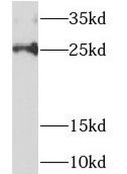 NDUFAF2 Rabbit Polyclonal Antibody