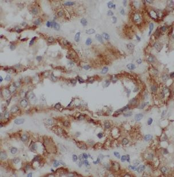NDUFB1 Rabbit Polyclonal Antibody