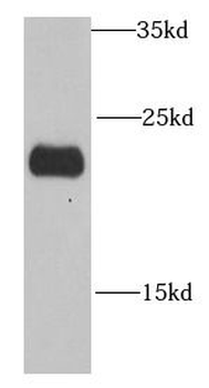 NDUFB10 Rabbit Polyclonal Antibody