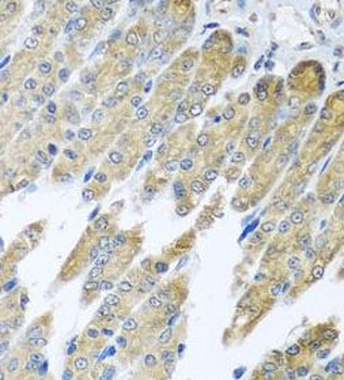 NDUFB10 Rabbit Polyclonal Antibody