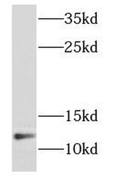 NDUFB2 Rabbit Polyclonal Antibody