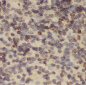 NDUFB2 Rabbit Polyclonal Antibody