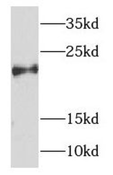 NDUFB7 Rabbit Polyclonal Antibody