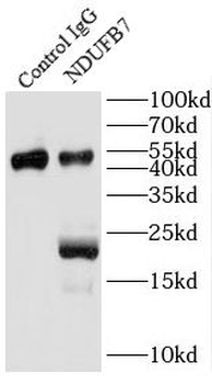 NDUFB7 Rabbit Polyclonal Antibody