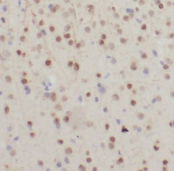 NDUFB7 Rabbit Polyclonal Antibody
