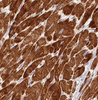 NDUFC1 Rabbit Polyclonal Antibody