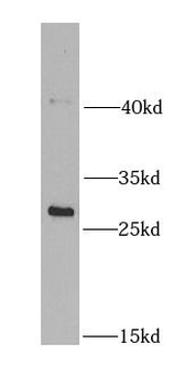 NDUFS3 Rabbit Polyclonal Antibody