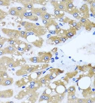 NDUFS3 Rabbit Polyclonal Antibody