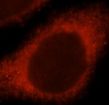 NDUFS7 Rabbit Polyclonal Antibody