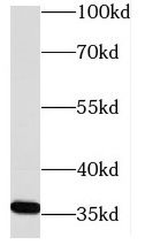 NECAP2 Rabbit Polyclonal Antibody