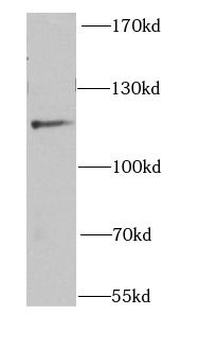 NEDD4L Rabbit Polyclonal Antibody
