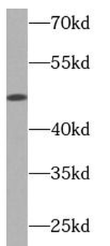 NEIL1 Rabbit Polyclonal Antibody