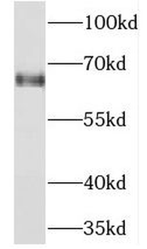 NEIL3 Rabbit Polyclonal Antibody
