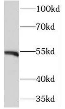 NEK11 Rabbit Polyclonal Antibody