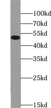 NEK2 Rabbit Polyclonal Antibody
