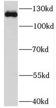 NEK9 Rabbit Polyclonal Antibody