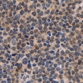 NEK9 Rabbit Polyclonal Antibody