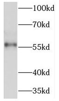 NSMF Rabbit Polyclonal Antibody