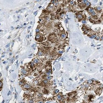 NSMF Rabbit Polyclonal Antibody