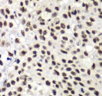 NELFE Rabbit Polyclonal Antibody