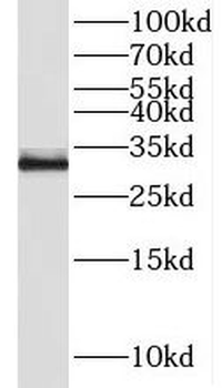 NEURL2 Rabbit Polyclonal Antibody