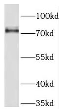 NCDN Rabbit Polyclonal Antibody
