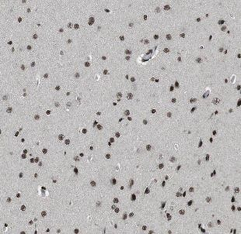 NCDN Rabbit Polyclonal Antibody