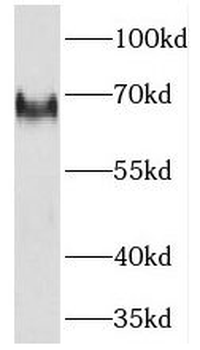 NF2 Rabbit Polyclonal Antibody